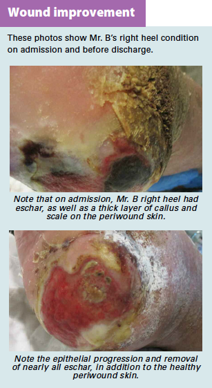 Wound Improvements