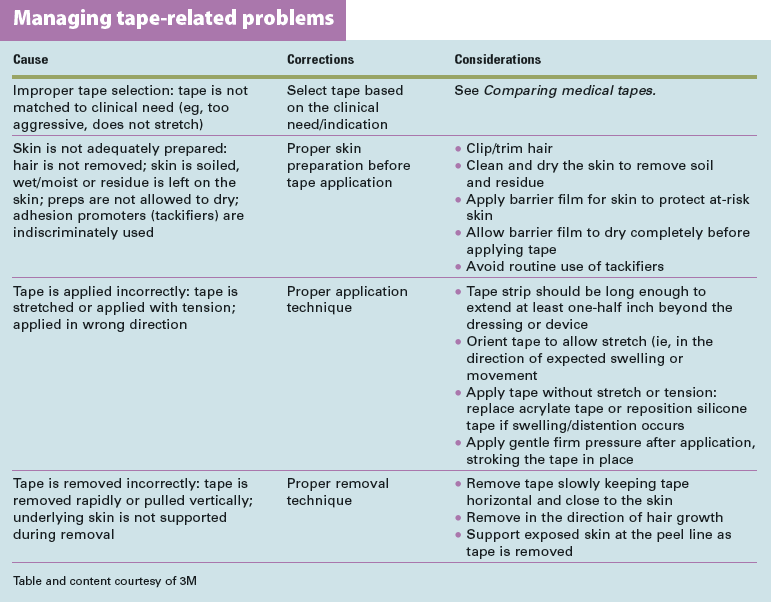 Managing tape-related problems