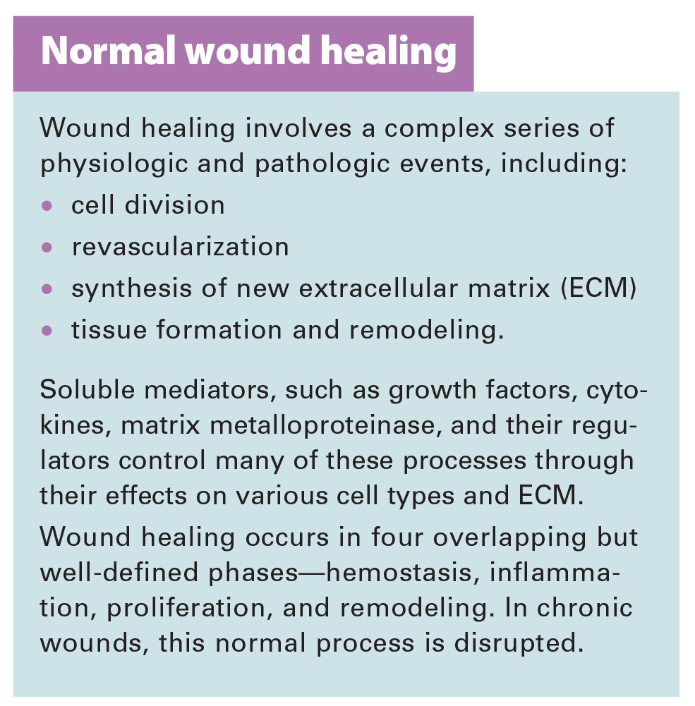 Wound healing Essays