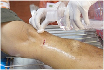 wound collagen dressing