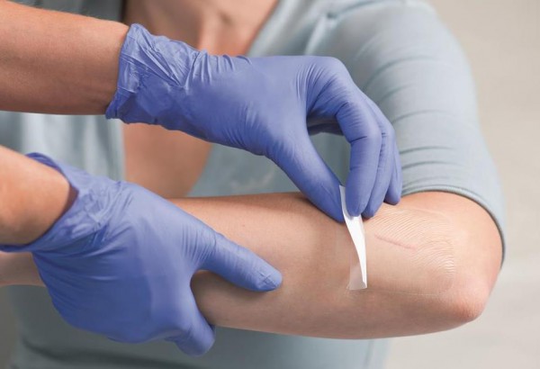 What you need to know about transparent film dressings - Wound Care Advisor