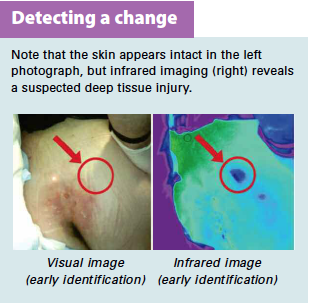 DETECTING A CHANGE