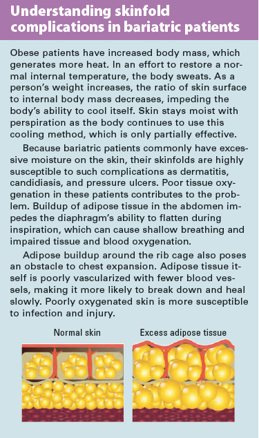 Bariatric Apple Pannus and Apple Ascities Body Types: Relation to Mobility  and Therapy