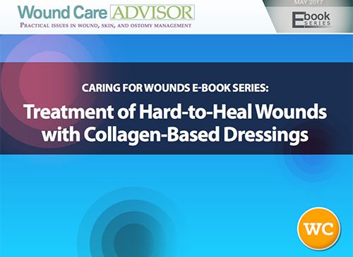 Treatment of Hard-to-Heal Wounds with Collagen-Based Dressings eBook