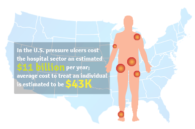 pressure injuries statistics