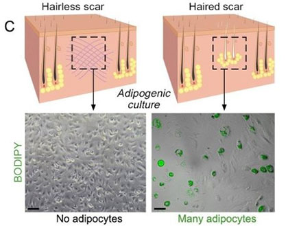 fat heal scars adipogenic culture
