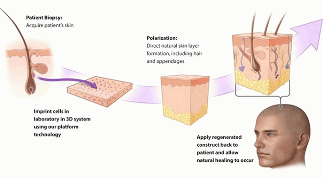 Regenerates Full-Thickness Hair-Bearing Skin in Burns and Wounds