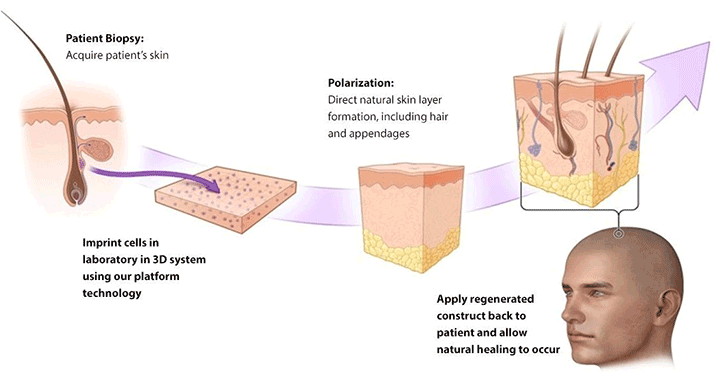 Regenerates Full-Thickness Hair-Bearing Skin in Burns and Wounds